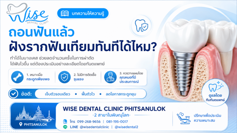 ถอนฟันแล้วฝังรากฟันเทียมทันทีได้ไหม?