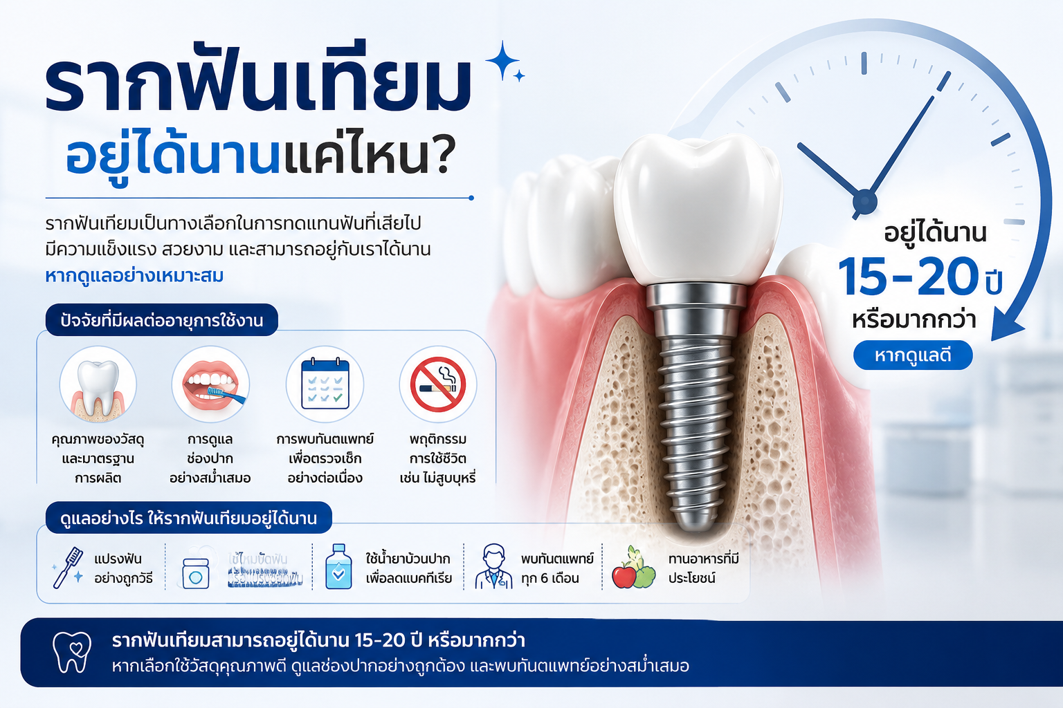 รากฟันเทียมอยู่ได้นานแค่ไหน